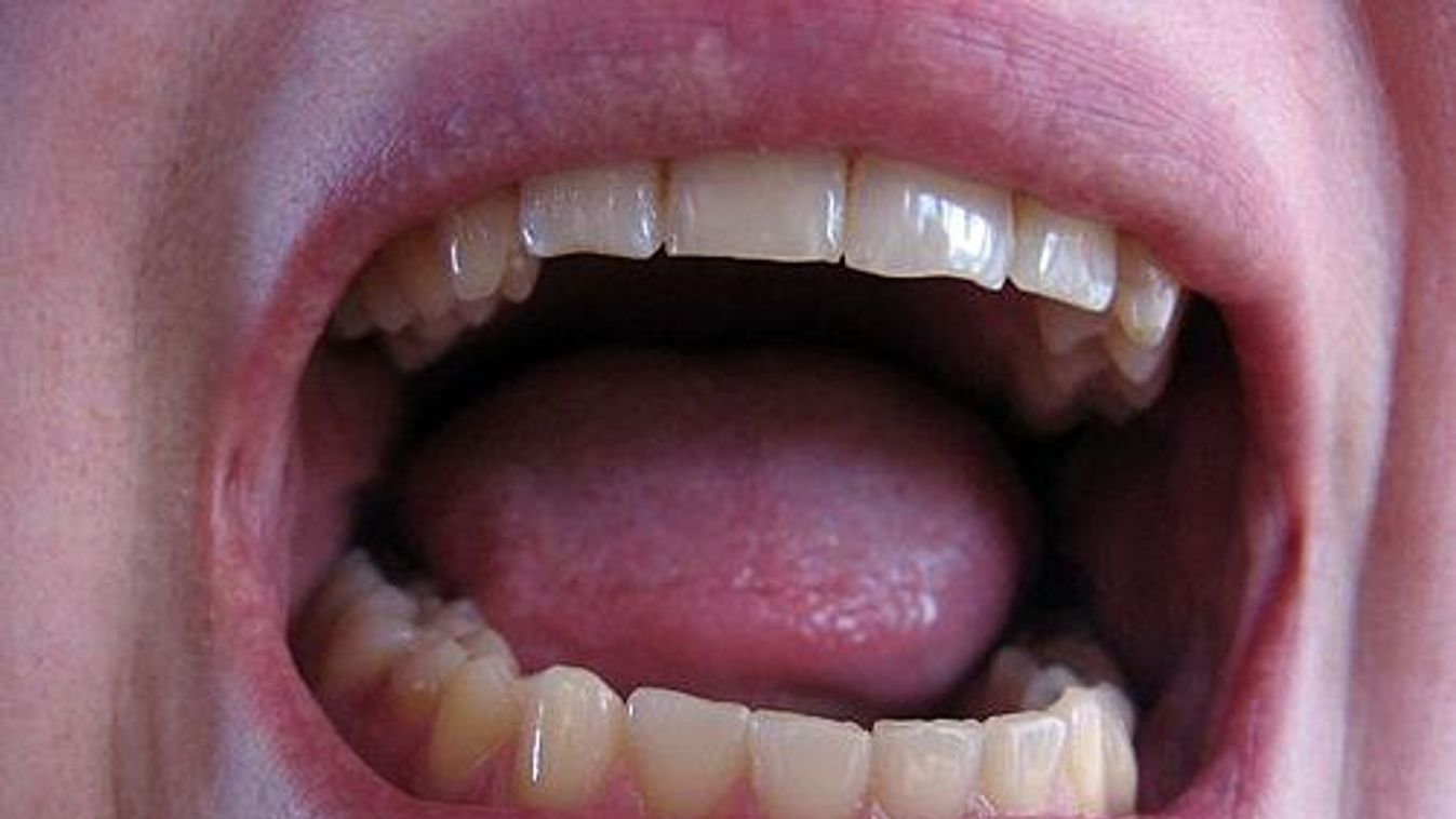 https://cdn.borsonline.hu/2010/11/0SBtPswlIoTlmBt5fDYDhHLVB7JS_6kJci0O1dZ7qDY/fill/1347/758/no/1/aHR0cHM6Ly9jbXNjZG4uYXBwLmNvbnRlbnQucHJpdmF0ZS9jb250ZW50LzA4MmQ4M2NhMjU4MDRmZDhiNmE4Y2RiOGUwMzdjNzE5.jpg