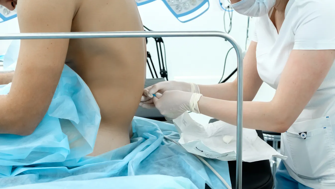 Epidurál: ne fájjon annyira, de érezze a fájásokat a kismama