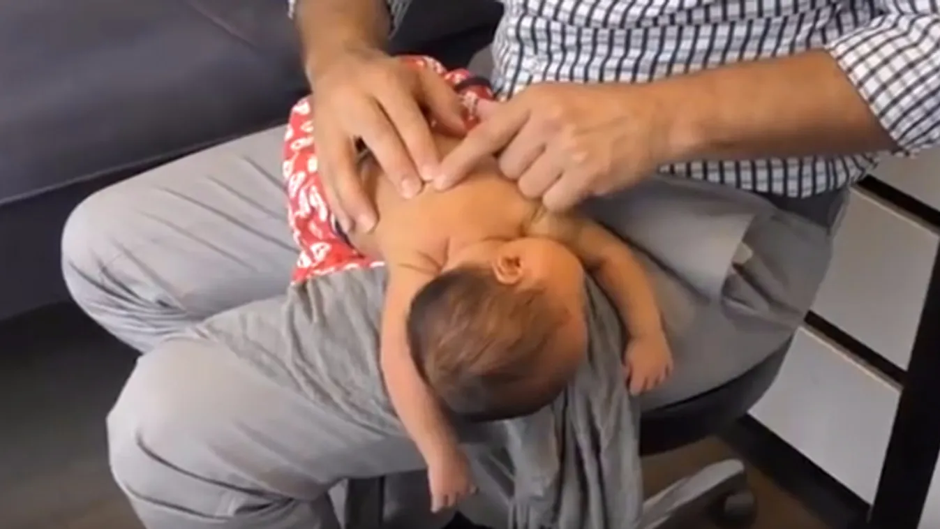 Brutálisat roppantott a doki a négyéves hátán - videó