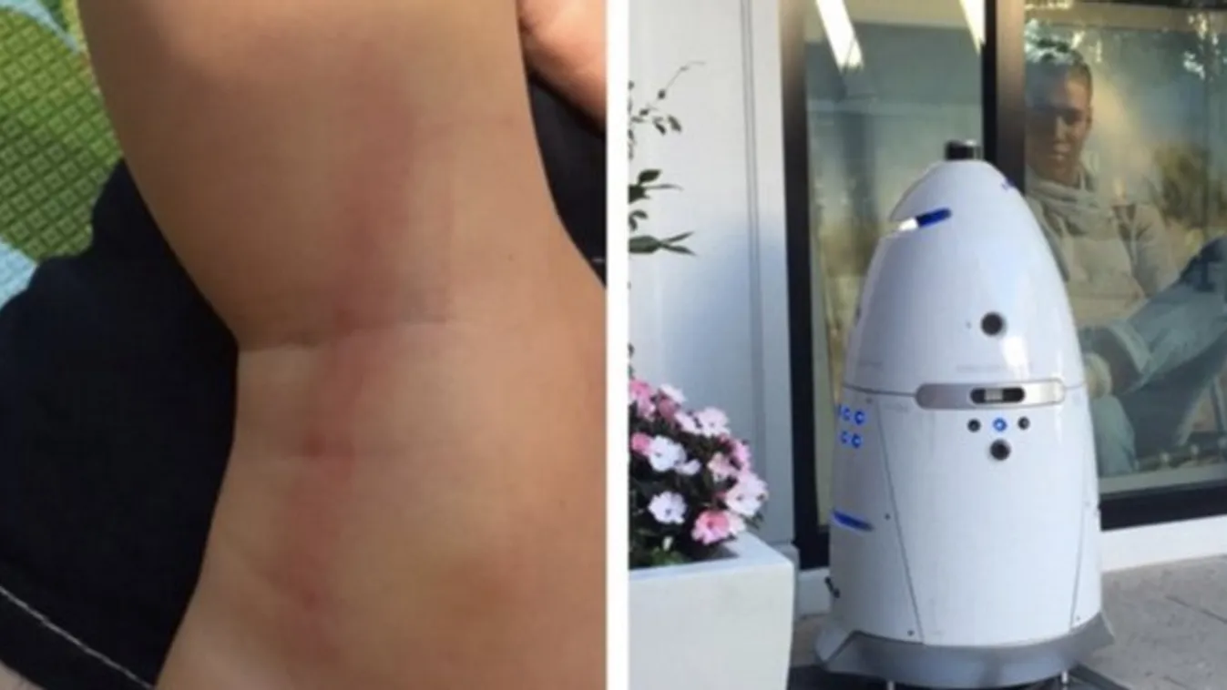 Robotzsaru gázolt el egy kisgyereket