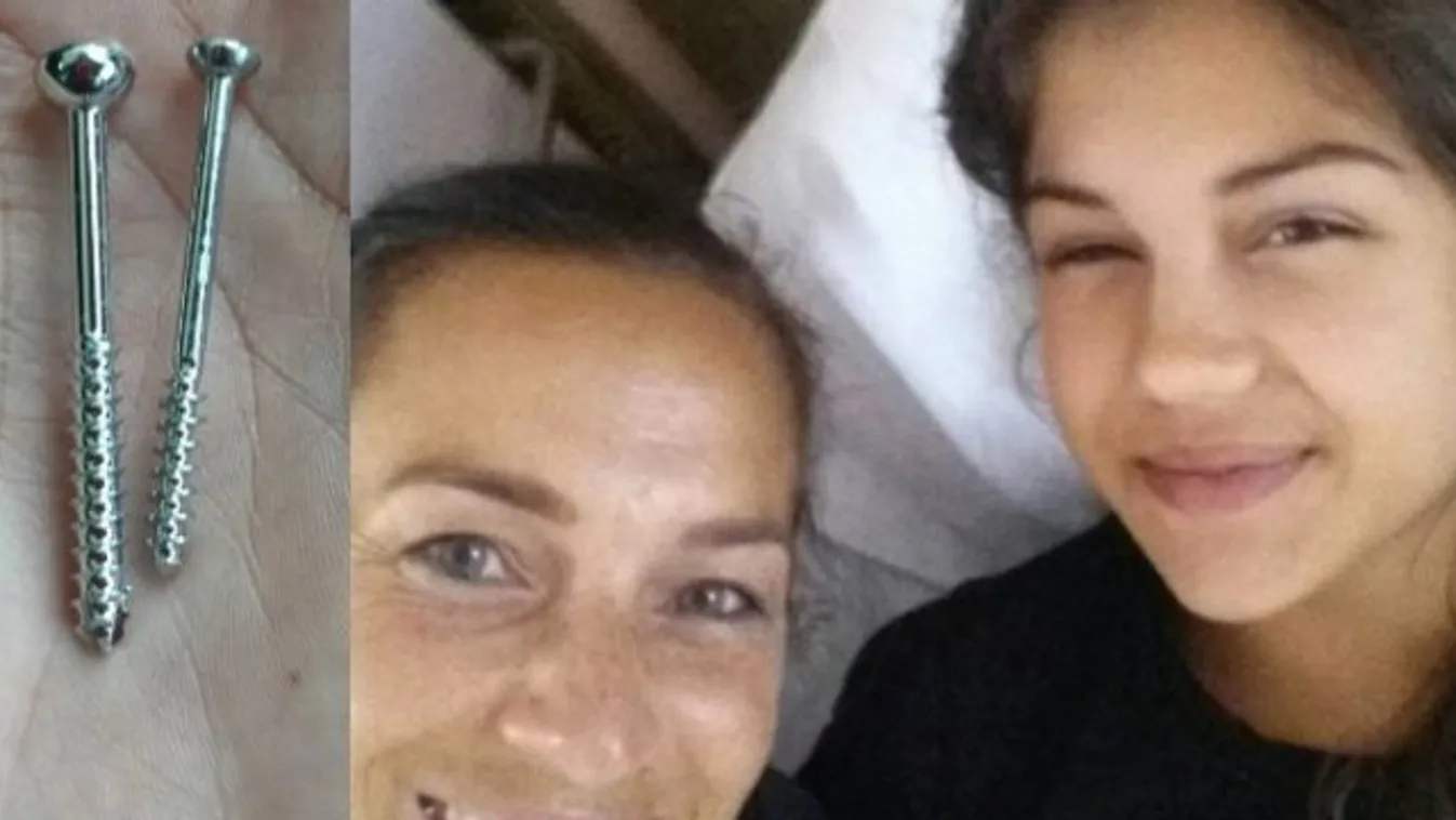 Komplikáció lépett fel műtét közben Fésűs Nelly lányánál