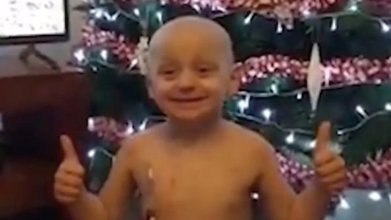 Ez az utolsó karácsonya az ötévesnek, mégis mosolyog - videó