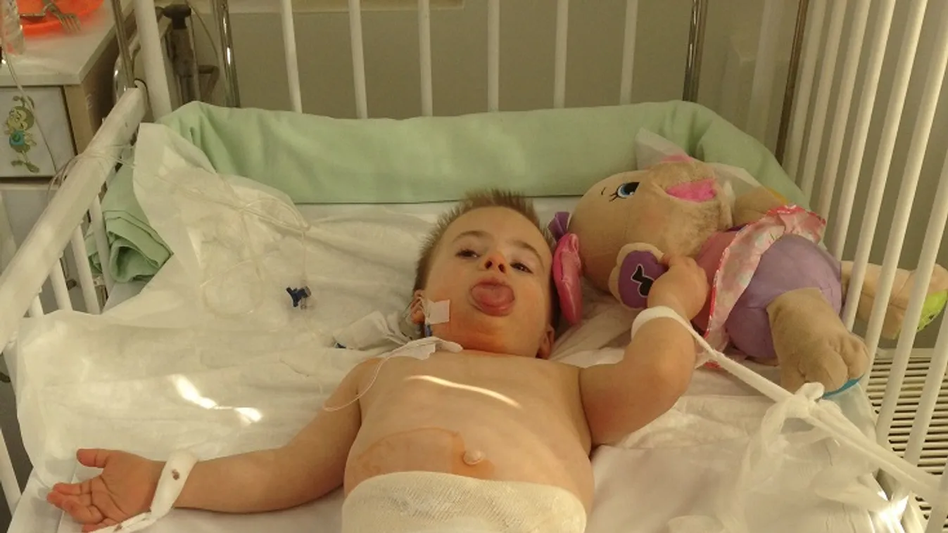 12 hétig volt fekvőgipszben Petya