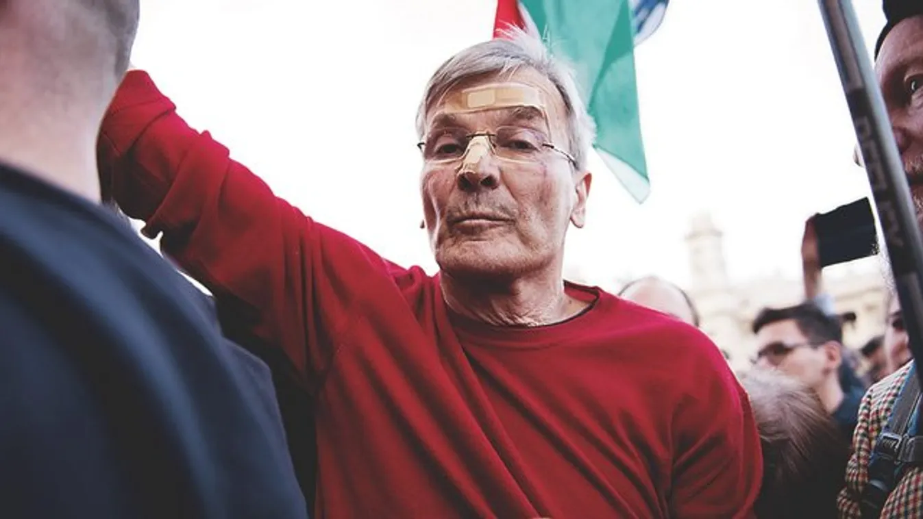 Sportolás közben zúzta szét az arcát Demszky Gábor