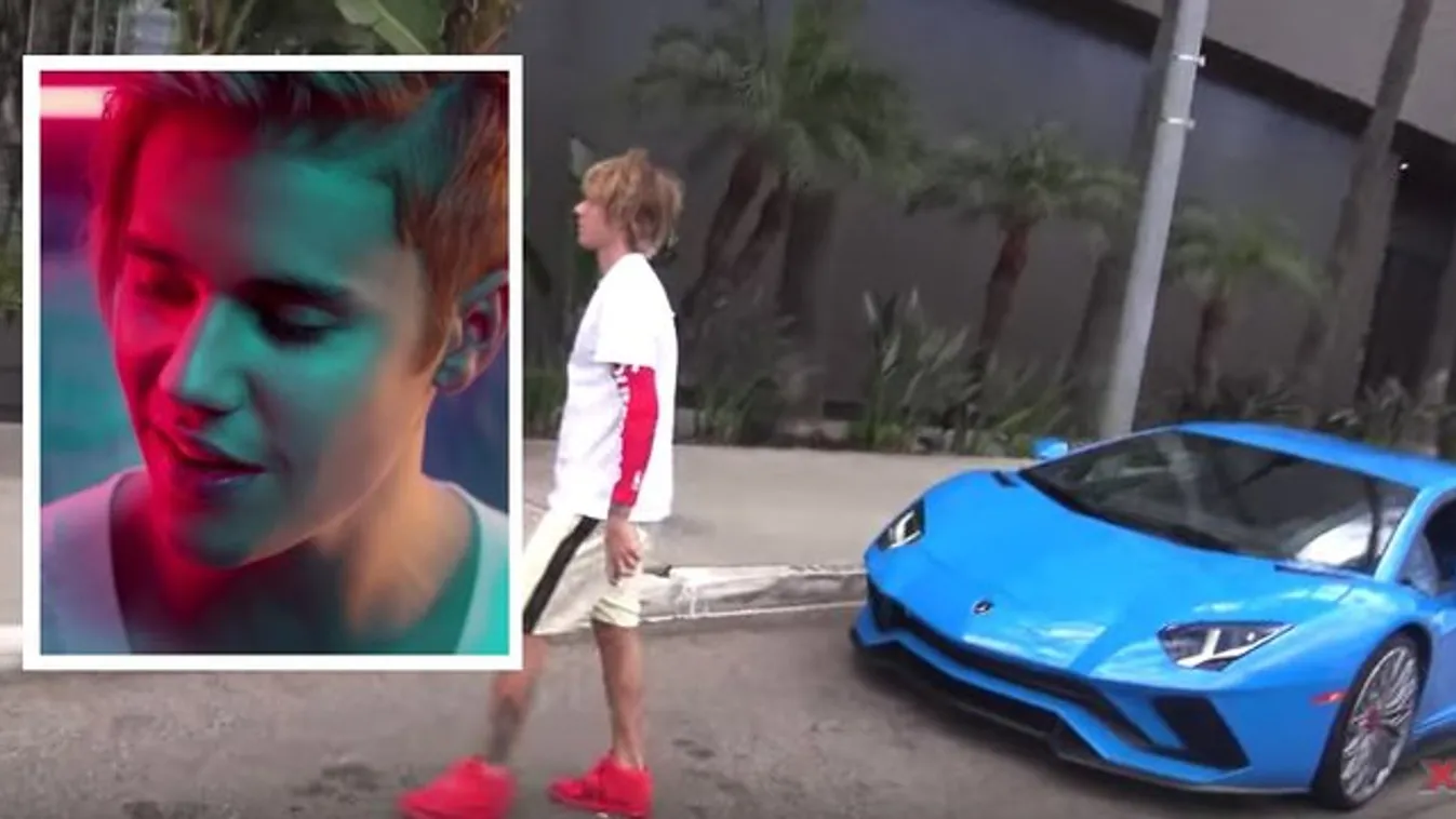 Hatalmasat égett Justin Bieber – videó
