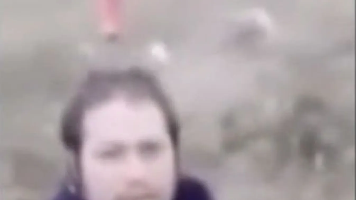 Furcsa indokkal vágott kést a saját fejébe egy férfi - 18+ videó