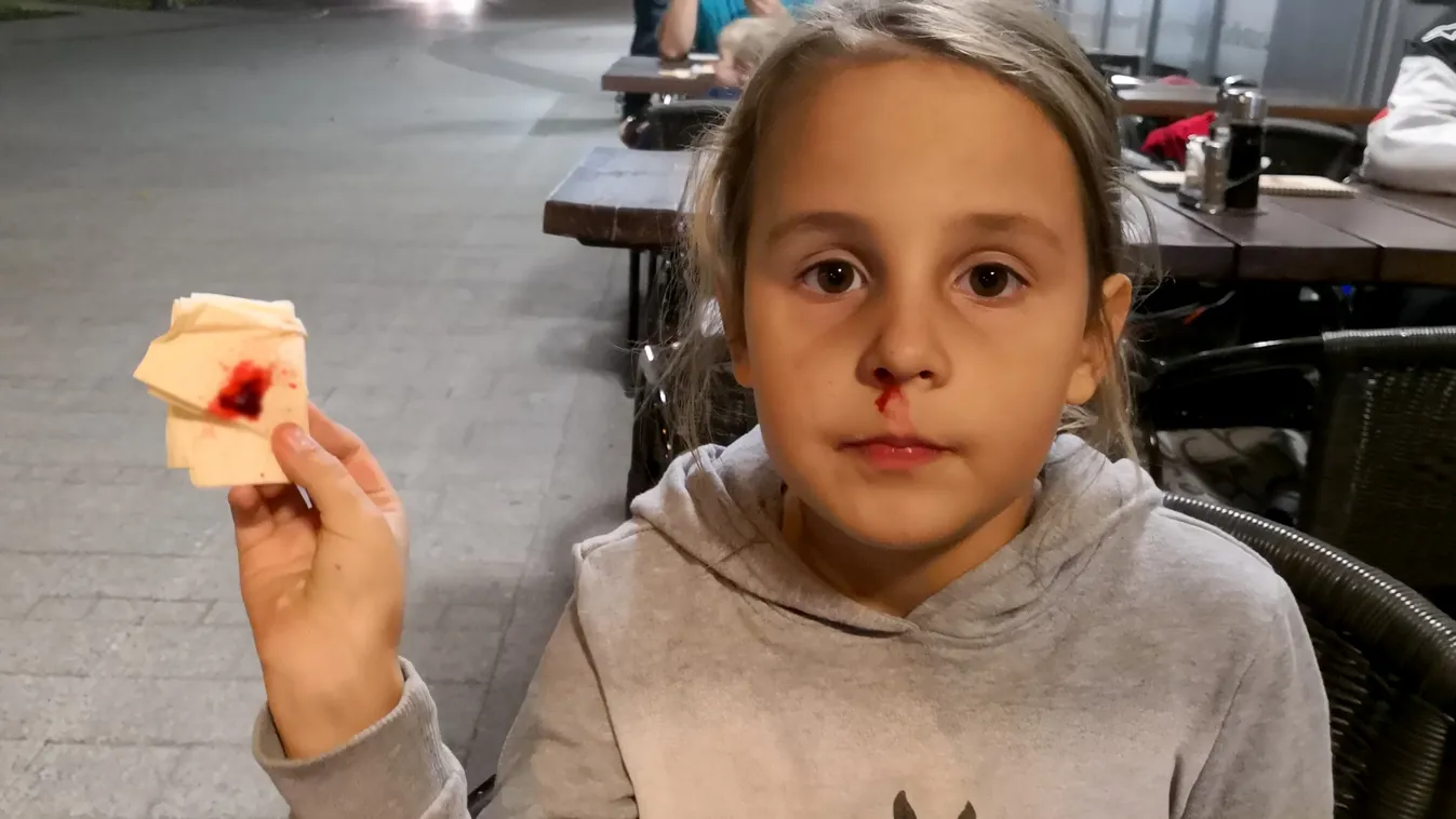 Dől a gyerek orrából a vér