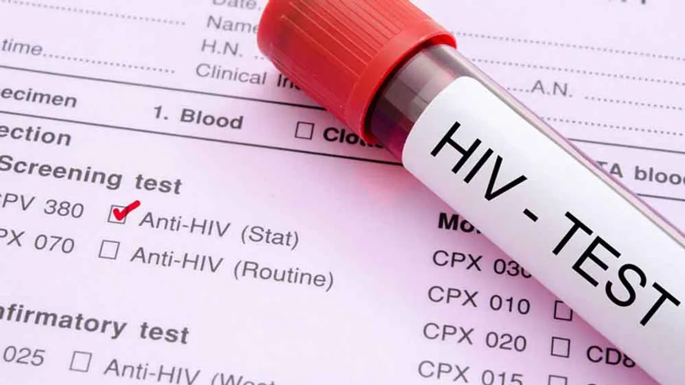 Videó – Rendszeres szűréssel világszerte megállítható a HIV-fertőzés