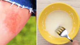 Tuti házi praktika: kókuszolaj a gyógyír a kidörzsölt bőrre