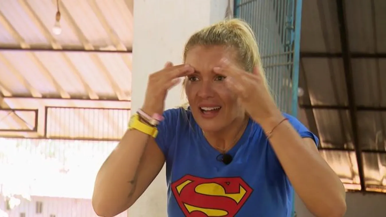 Botox bénította le Hódi Pamela arcát