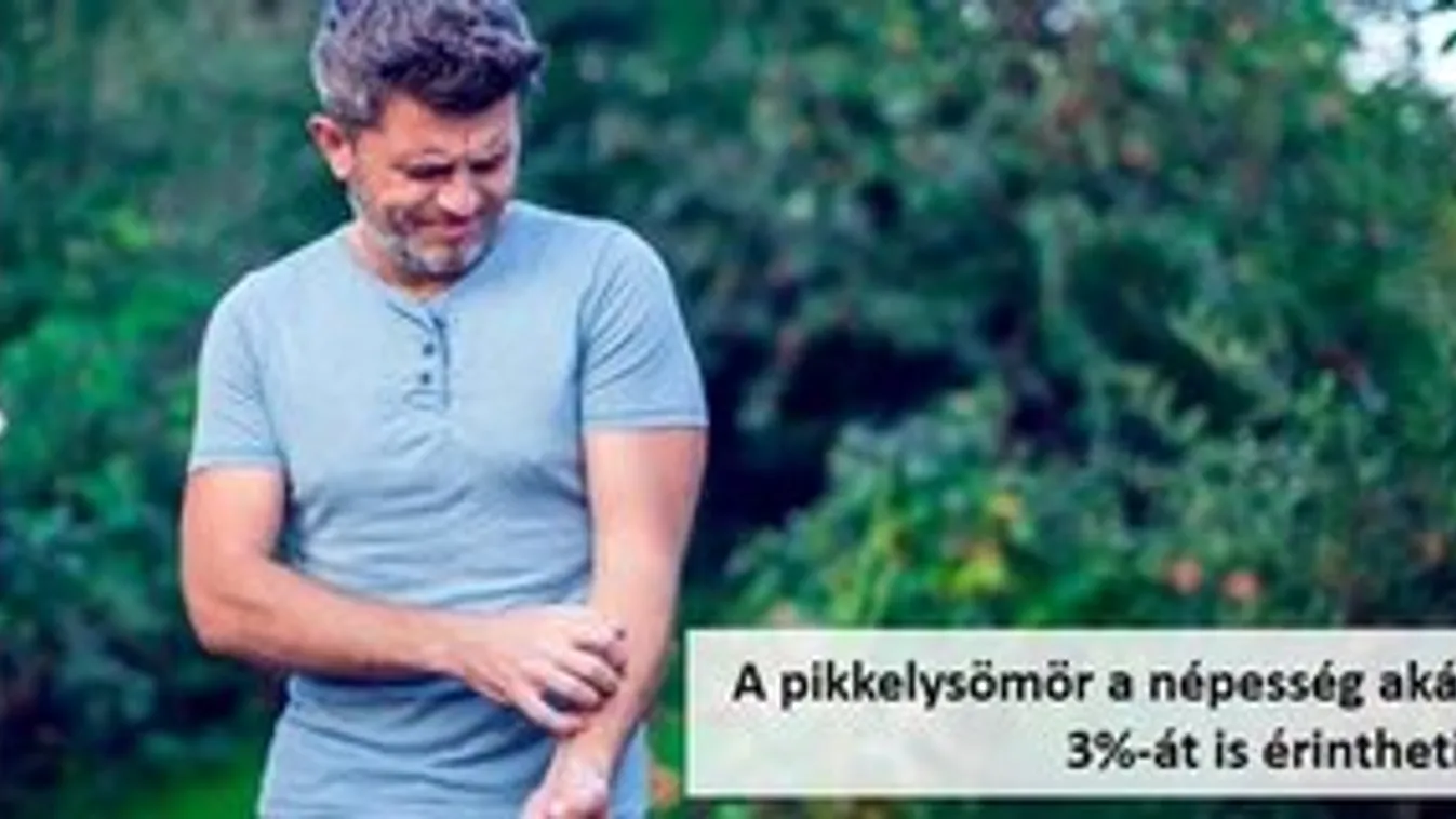 A pikkelysömör tünetei és kezelése (x)