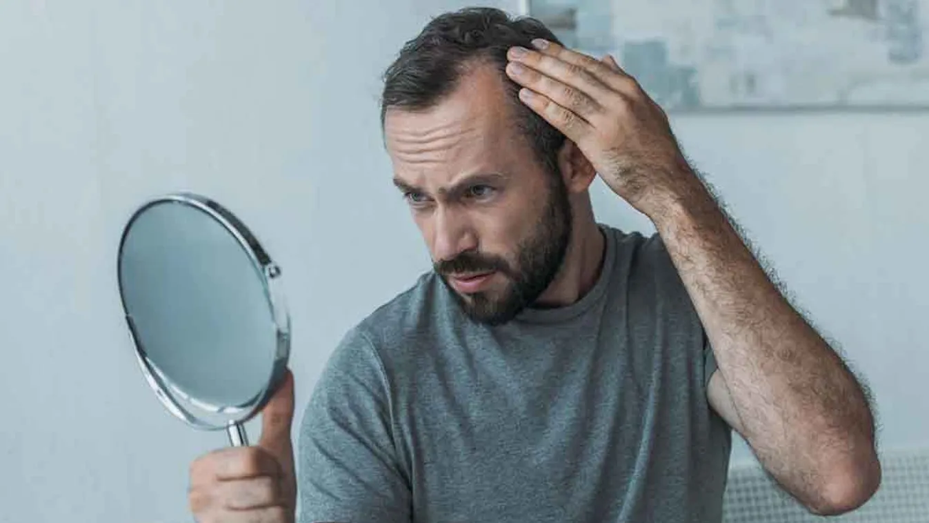 Hajhulláskezelés őssejtek segítségével? – Igen, lehetséges!