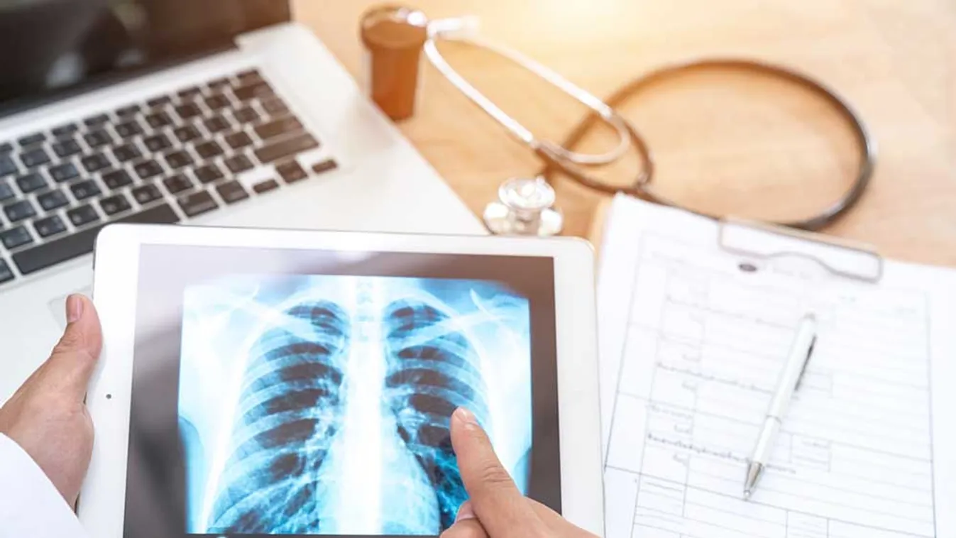 Megelőzés és korai diagnózis – Így küzdhető le a tüdőrák