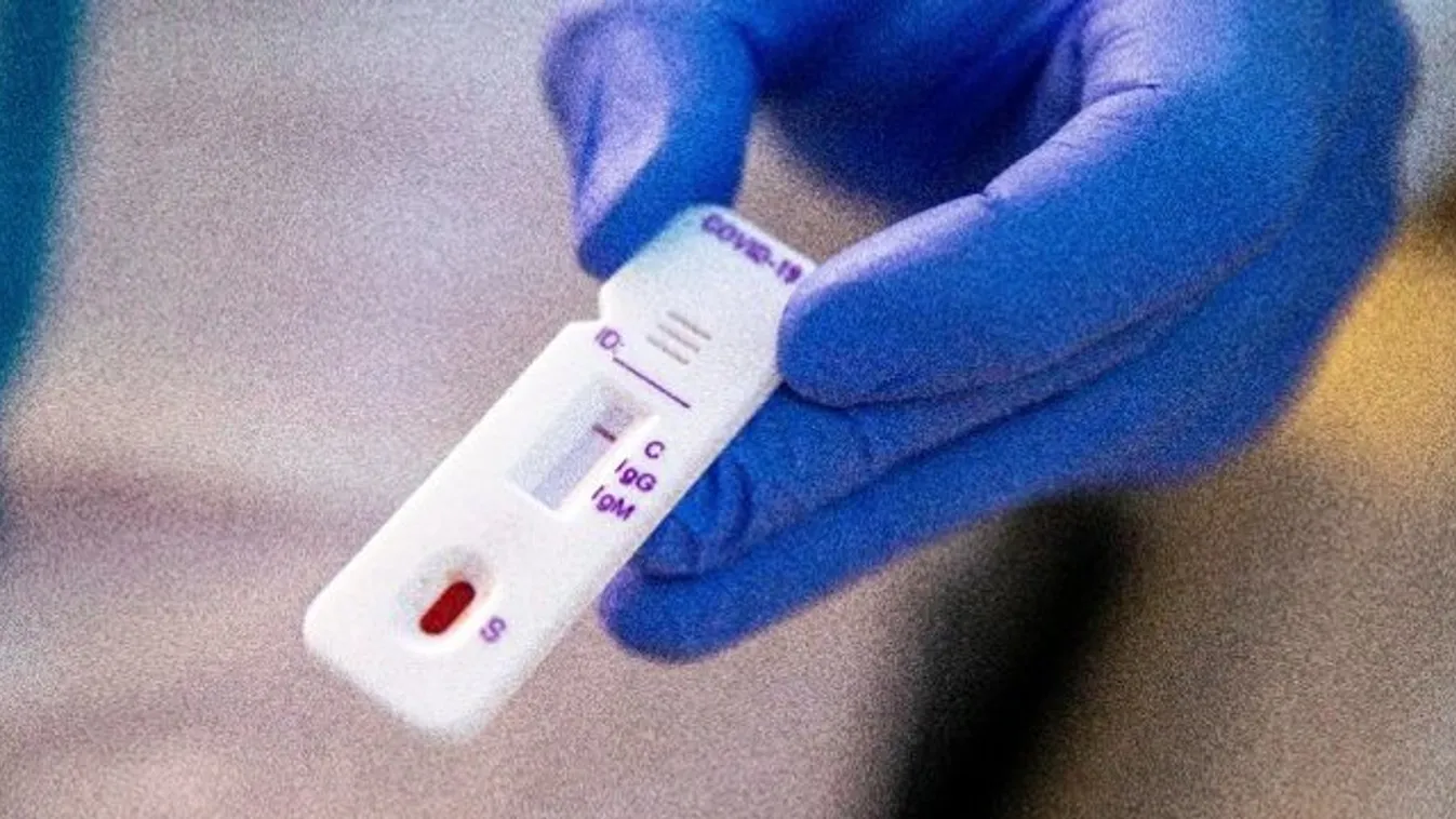 Miniszterelnökség: újabb szakmai csoport célzott koronavírus-tesztelése kezdődik meg hétfőn