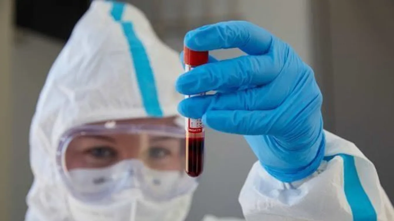 Oroszország túljutott a koronavírusos megbetegedések esetszámának tetőzésén