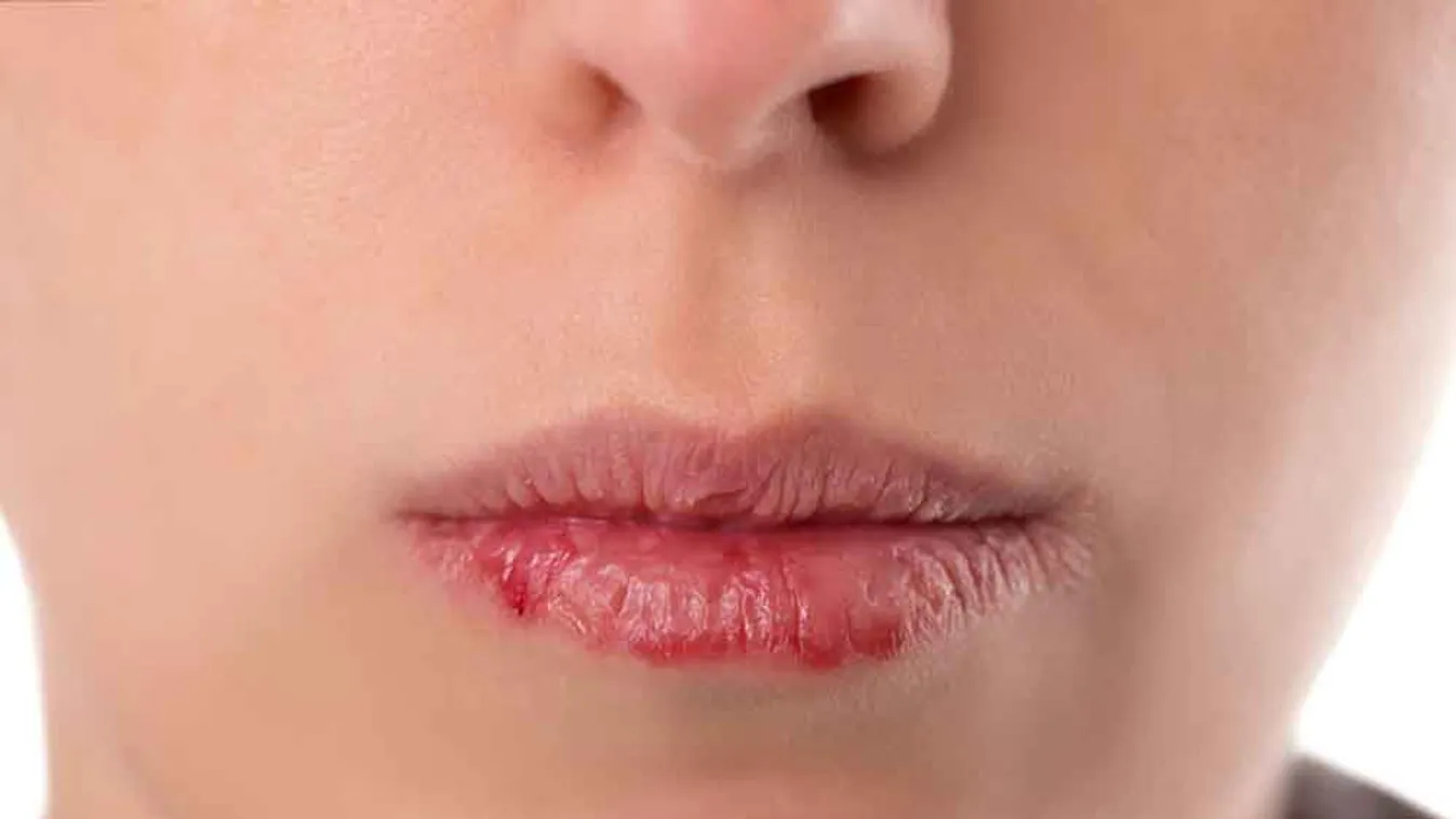 Top 5 tipp a cserepes ajkak ellen - Milyen módszerek válnak be?