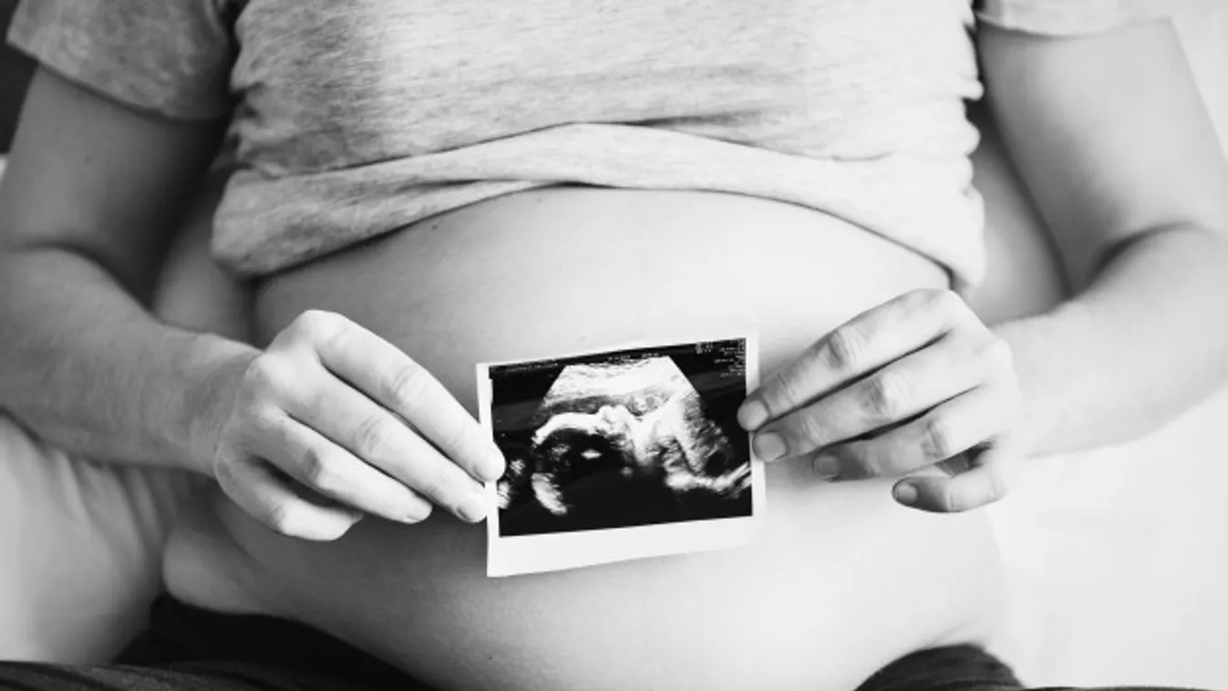 24 éves lenne a lányom. 38 hetesen meghalt bennem