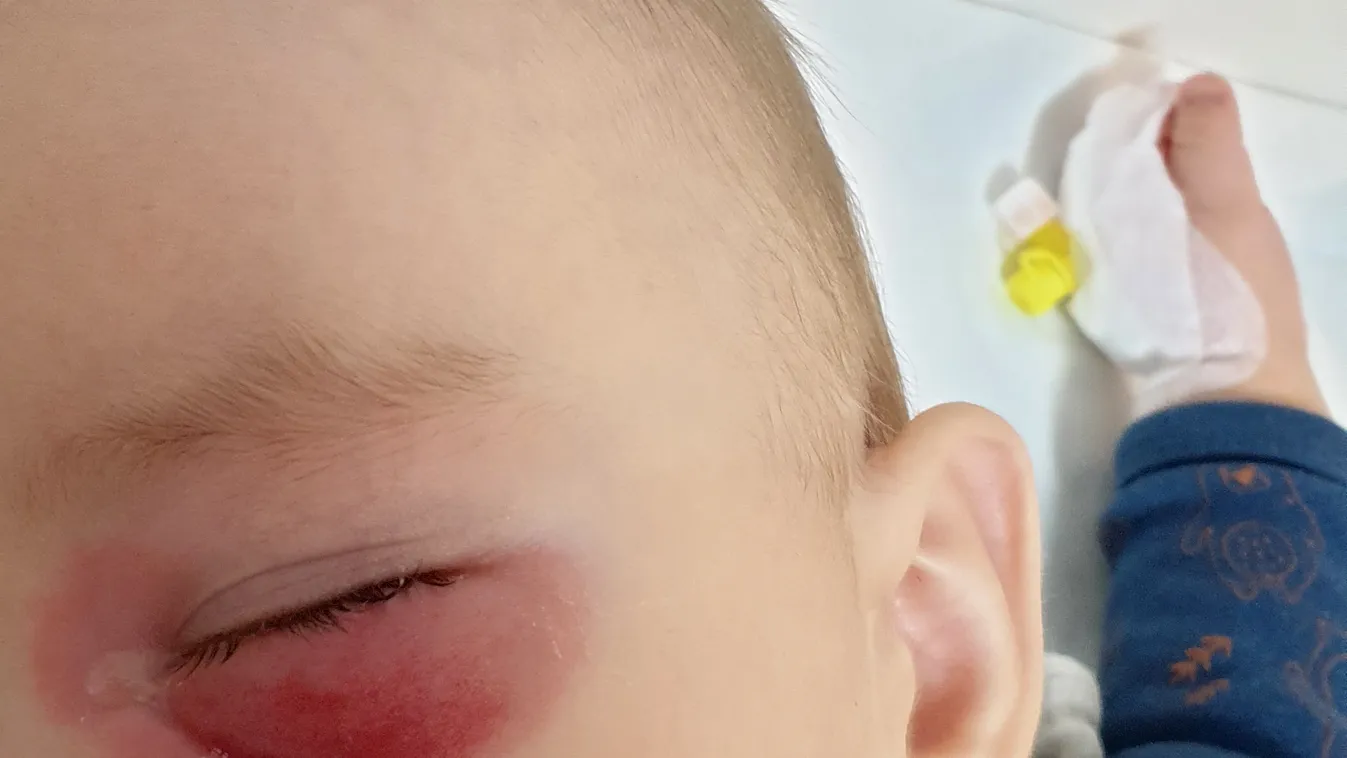 Tizennyolcszor szúrták meg a 8 hónapos babát