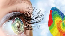 Ezek a leggyakoribb tévhitek a zöldhályogról