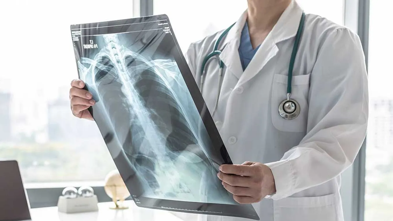 Két új gyógyító eljárás a Pulmonológiai Intézetben