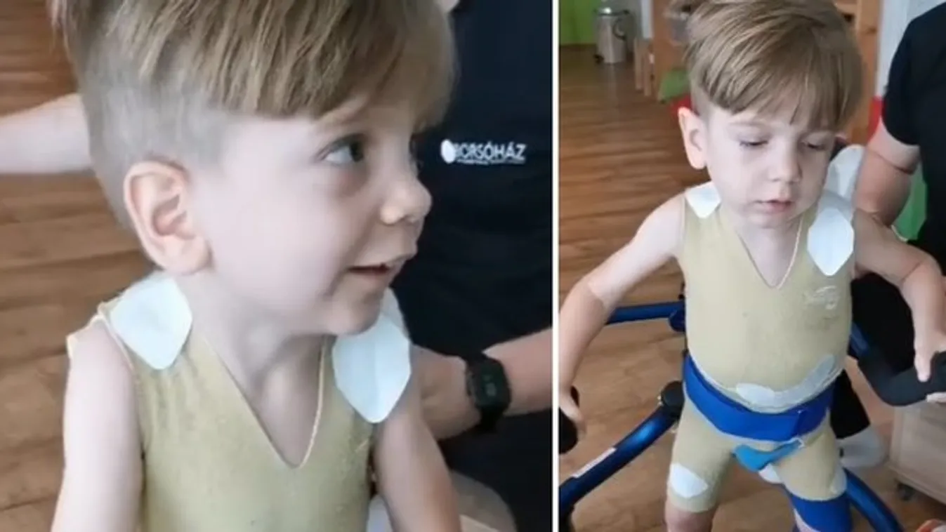 Hihetetlen, mennyit javult az SMA-s Zente állapota: így van most – videó
