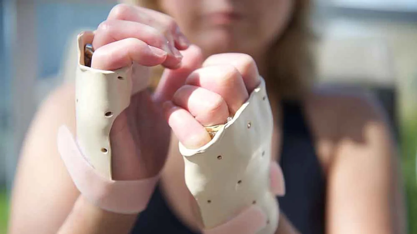 Scleroderma - Betegség, amely testünk kötőszöveteit érinti