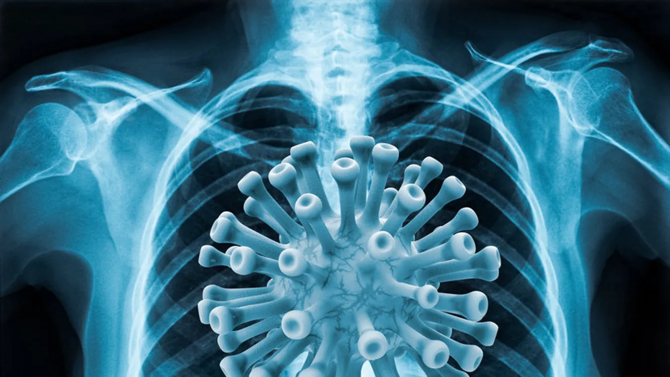 COVID és influenza - Így lehet megkülönböztetni