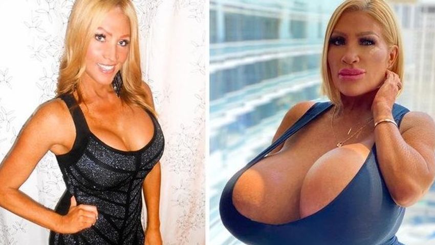 Woman Self-Inflated Her Breast Implants to Weigh 20 Lbs.: 'I Love Being in  Control'