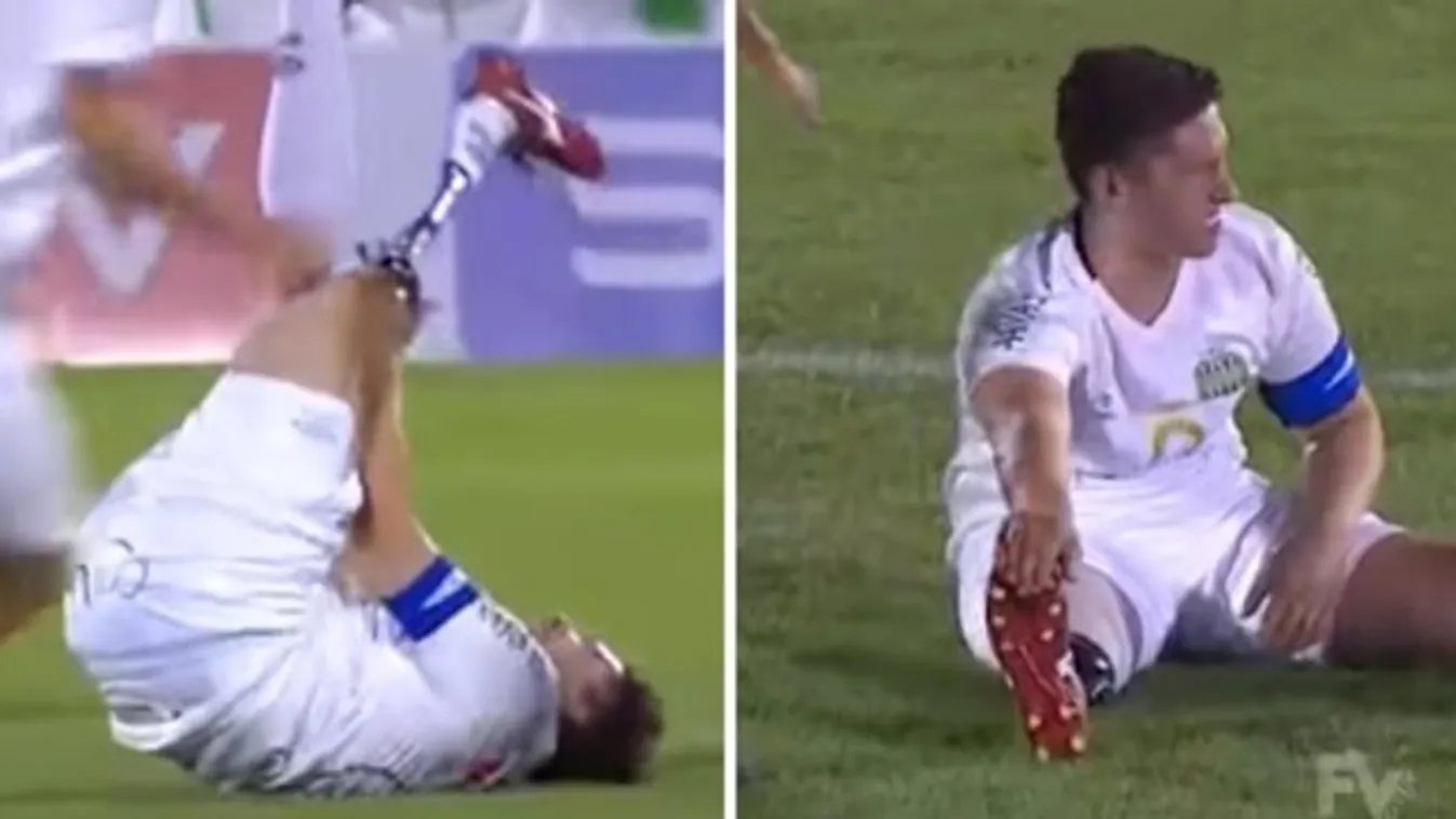 Begörcsölt a focista műlába – videó