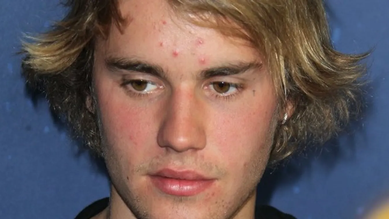 Rosszul néz ki Justin Bieber a szakítás után