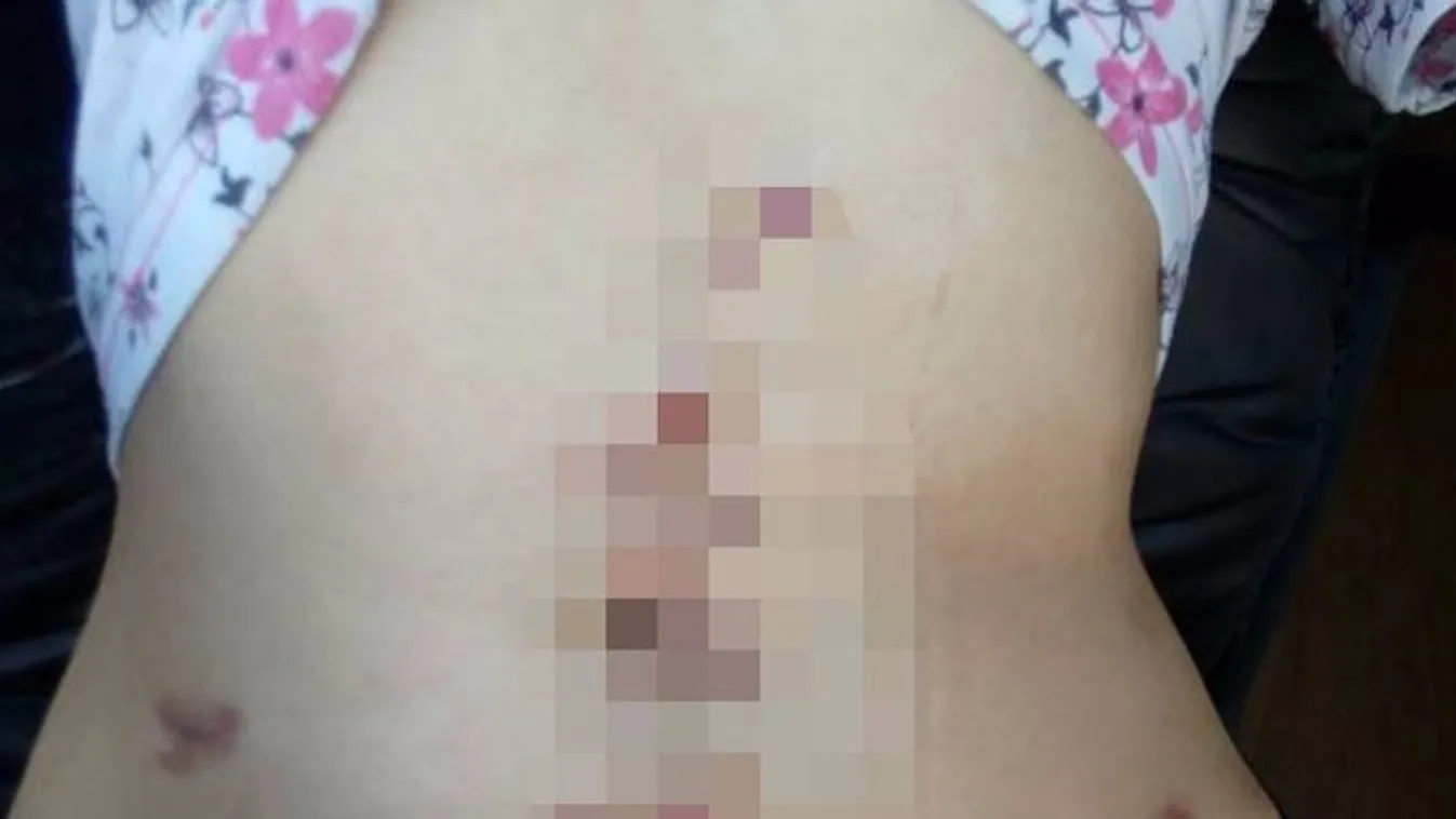 Úgy megverték a szexrabszolgát, hogy a strici sem hitte el, hogy életben maradt - 18+ fotók