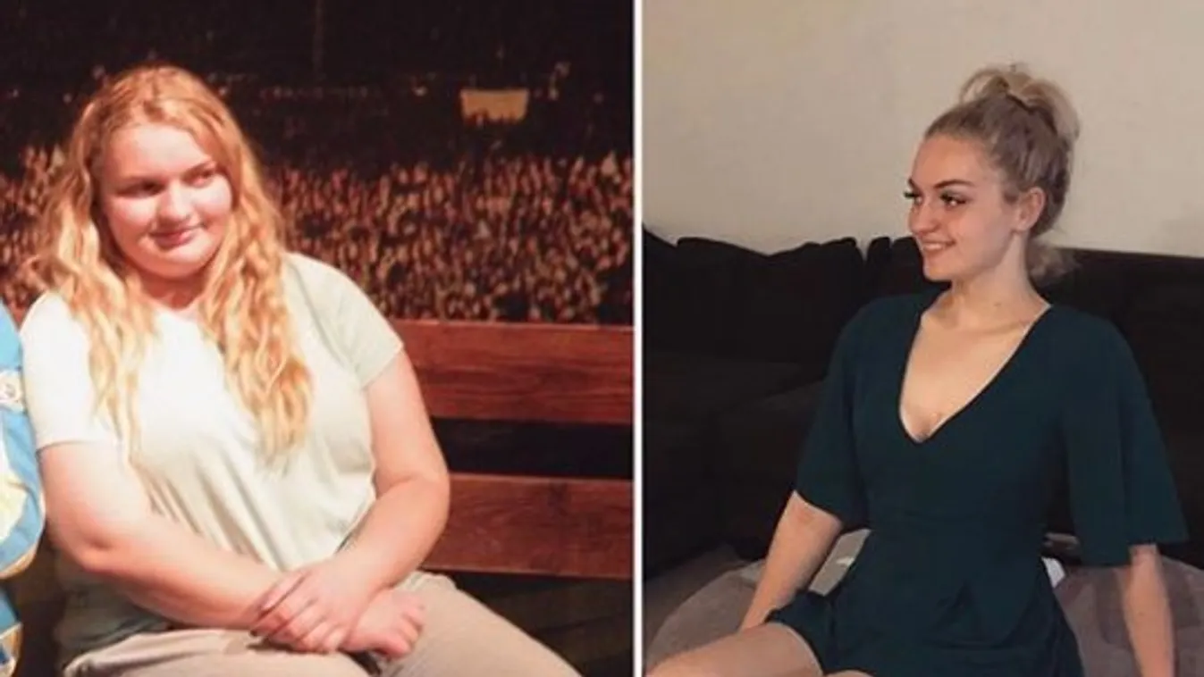Alig egy év alatt az Instagram miatt fogyott 60 kilót a tinilány