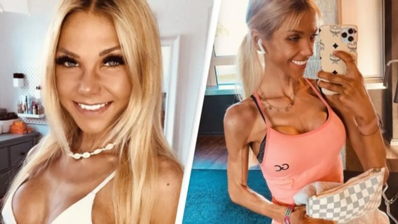 24 év adatott meg az angyalnak: barátja karjaiban aludt el örökre az anorexiás lány