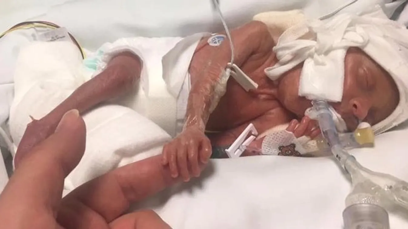 Ez a szülés örökre megváltoztatta az anya véleményét az abortuszról