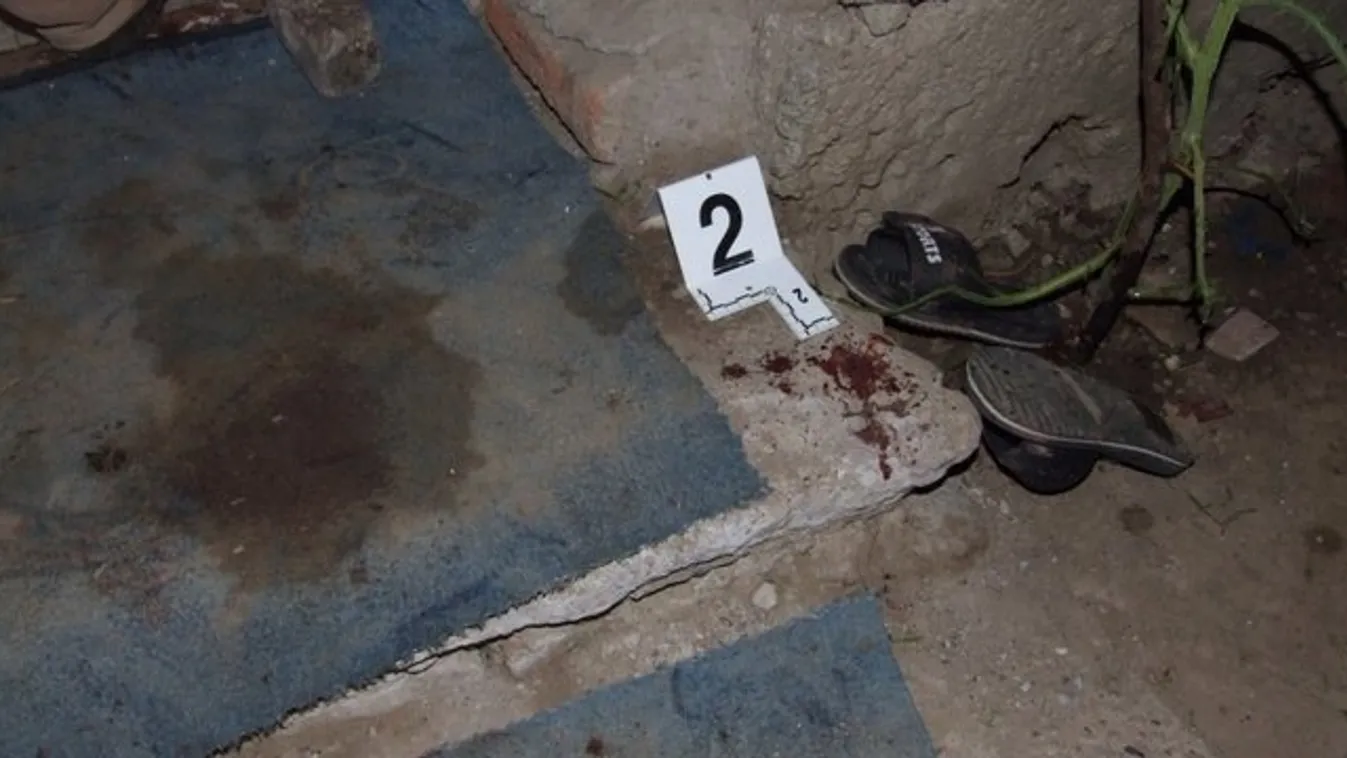Bozótvágóval vágta homlokon élettársát Arlón – képek (18+)