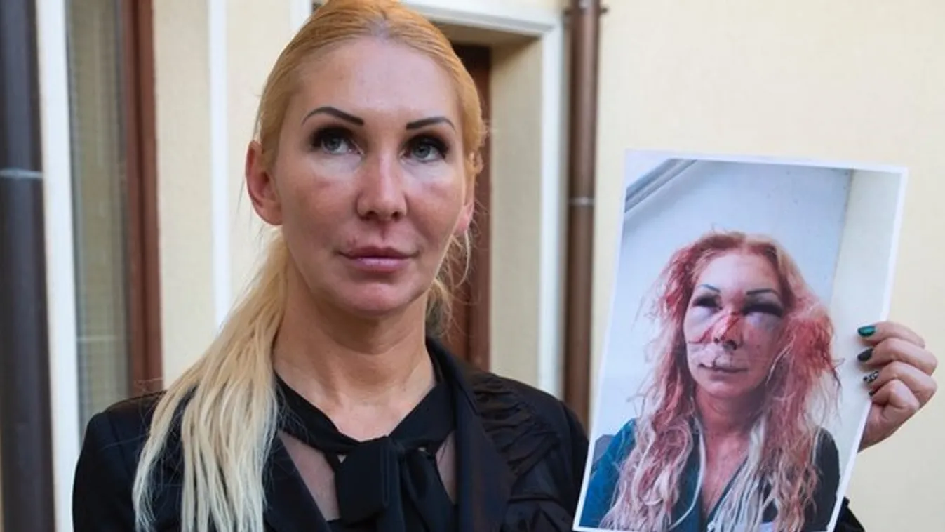 Nem emlékszik a támadásra a volt katona, aki most ötmilliót követel Bernadettől