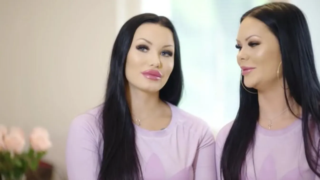 Bizarr: ikrekké műttették magukat a barátnők - videó