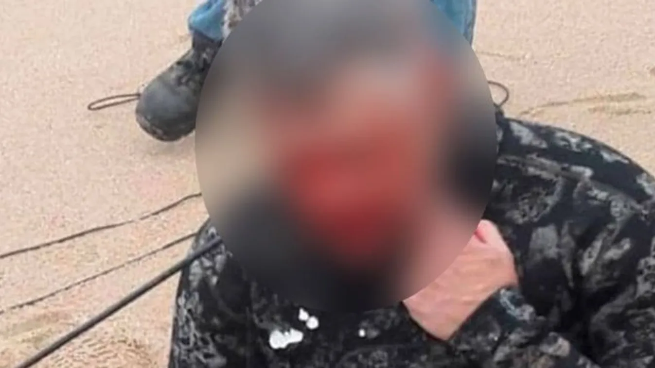 Fejbe lőtte magát a szigonypuskájával egy búvár – 18+ videó