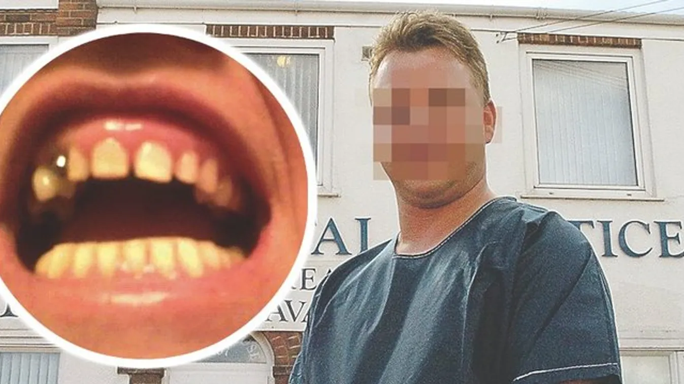 Nem lelik a magyar horrorfogorvost