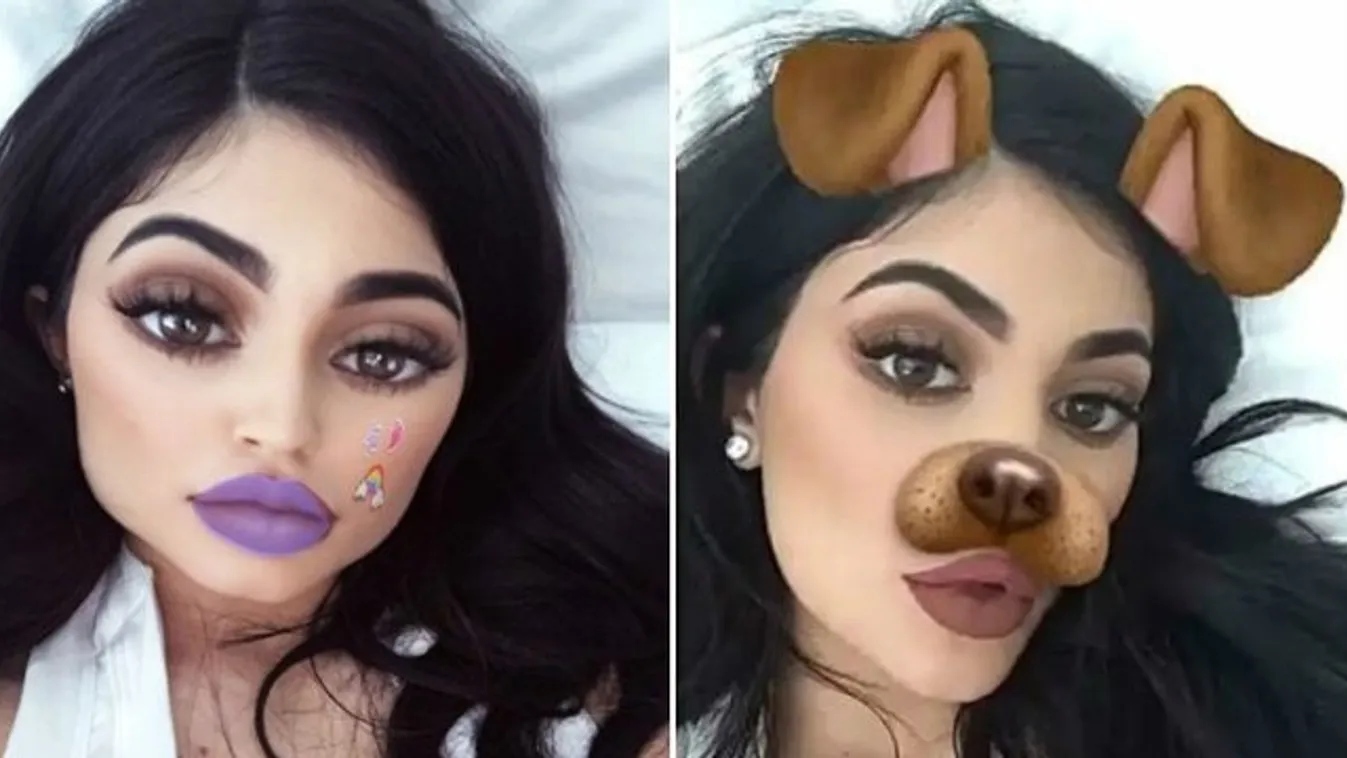 Snapchat-filterre akarok hasonlítani! - követelik a fiatalok a plasztikai sebészektől