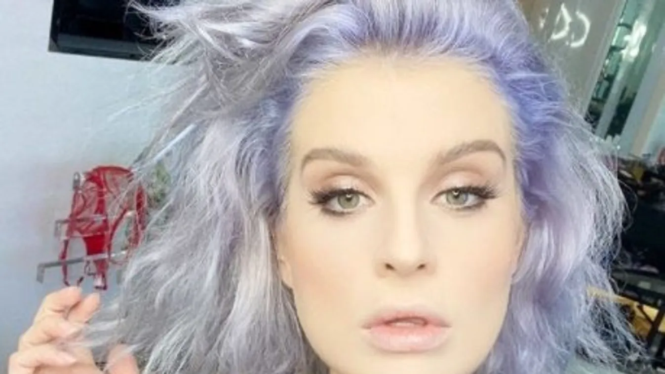 Durván megsérült Kelly Osbourne: szemkötőt kell hordania – fotó