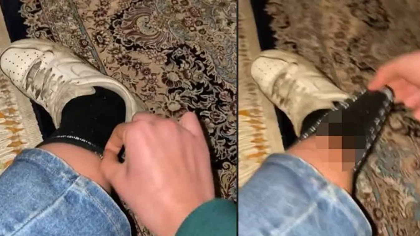 Horror, mit talált a zoknija alatt a fiatal nő – nem csoda, hogy képtelen volt abbahagyni a sikoltozást – videó