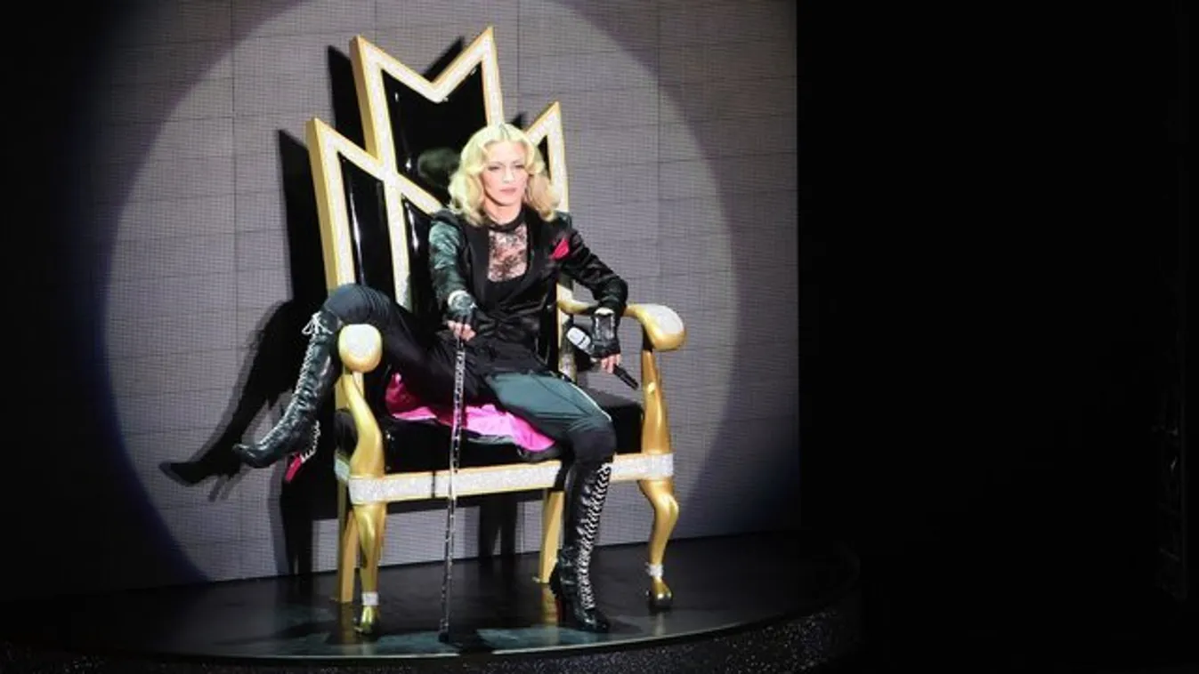 Madonna nemrég köpölyözésen járt, megmutatta, hogy néz ki utána a teste