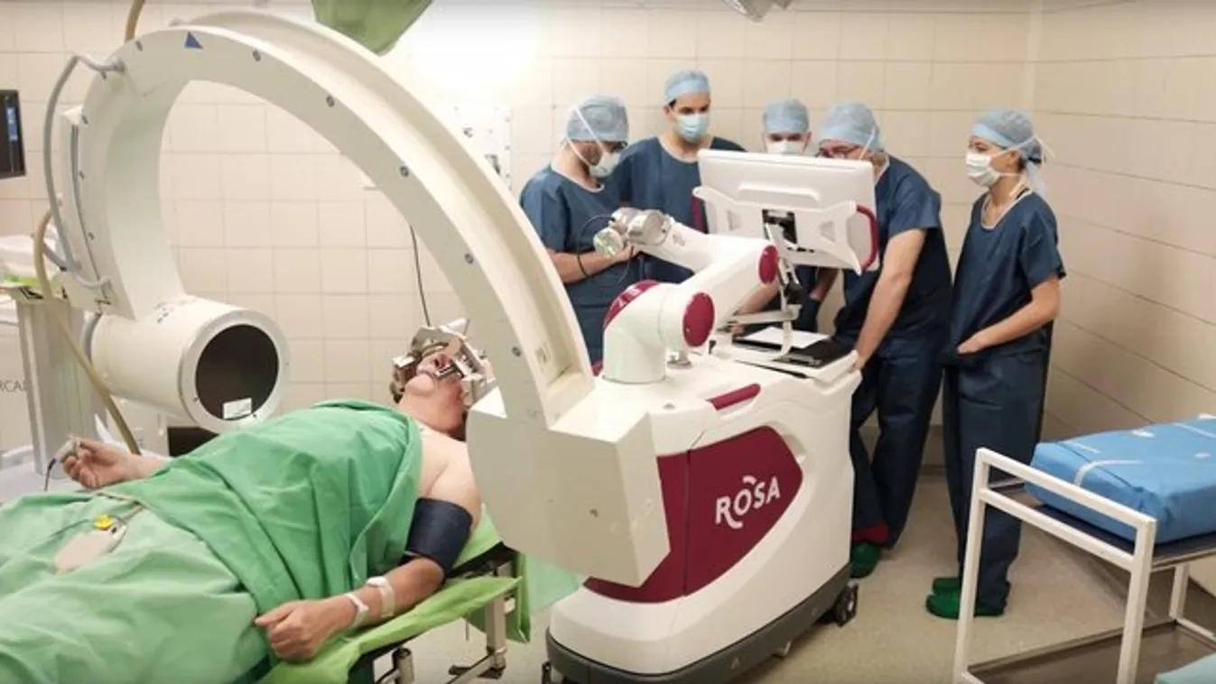 Először végzett agyműtétet a robot