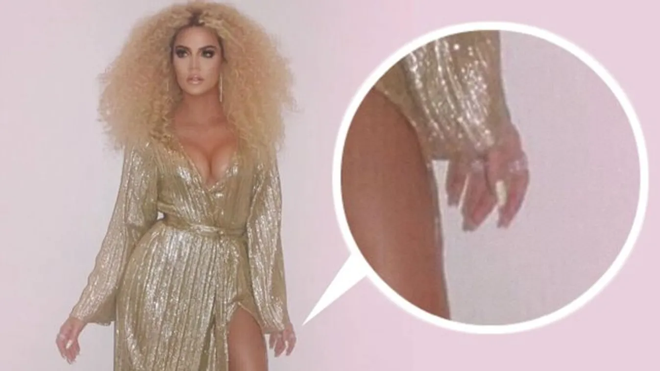 Kínos baki: 14 ujja van a Kardashian-lánynak