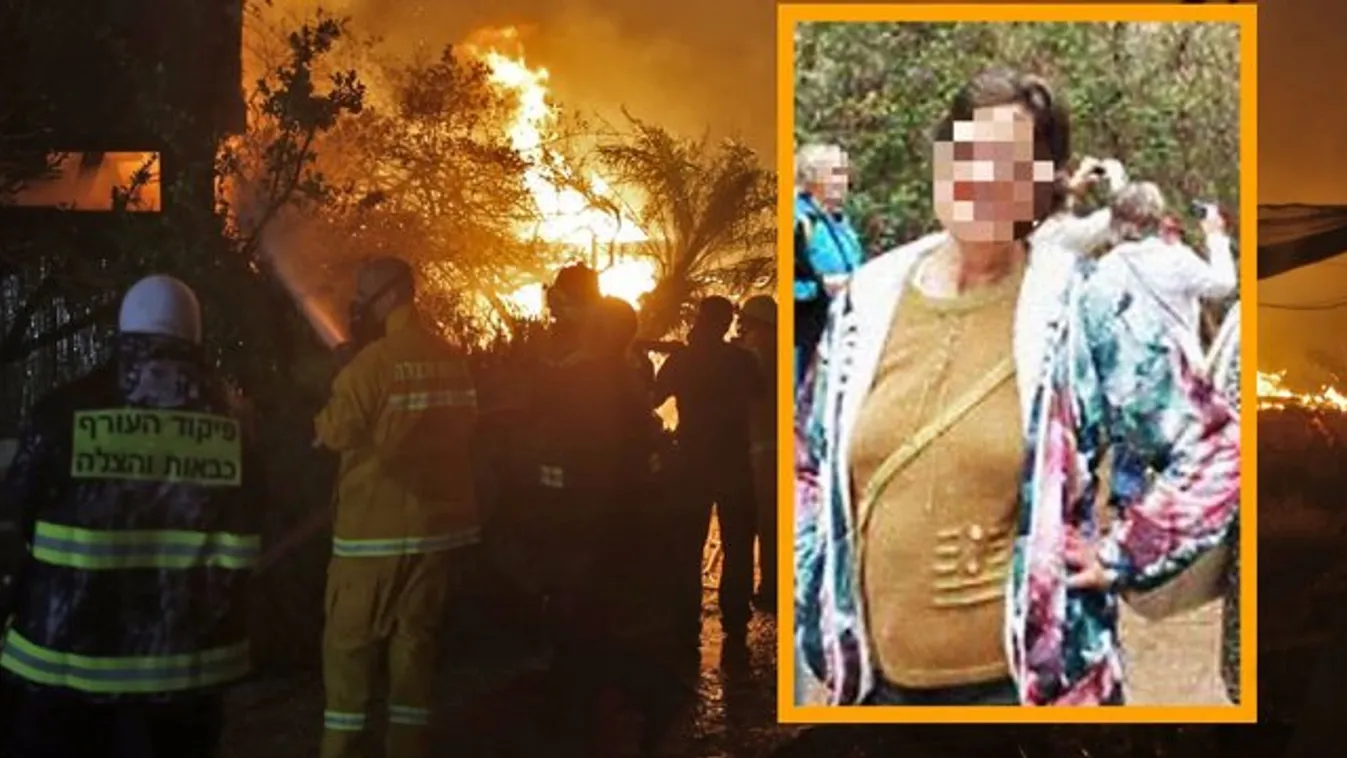 Segítségre vár a megégett magyar ápolónő