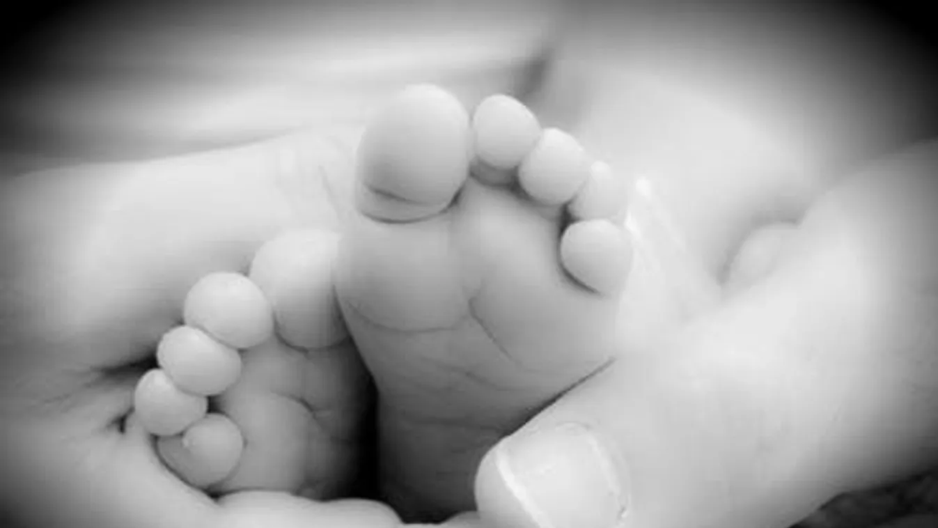 Horror a szülőszobán: leszakította az orvos a csecsemő fejét - 18+