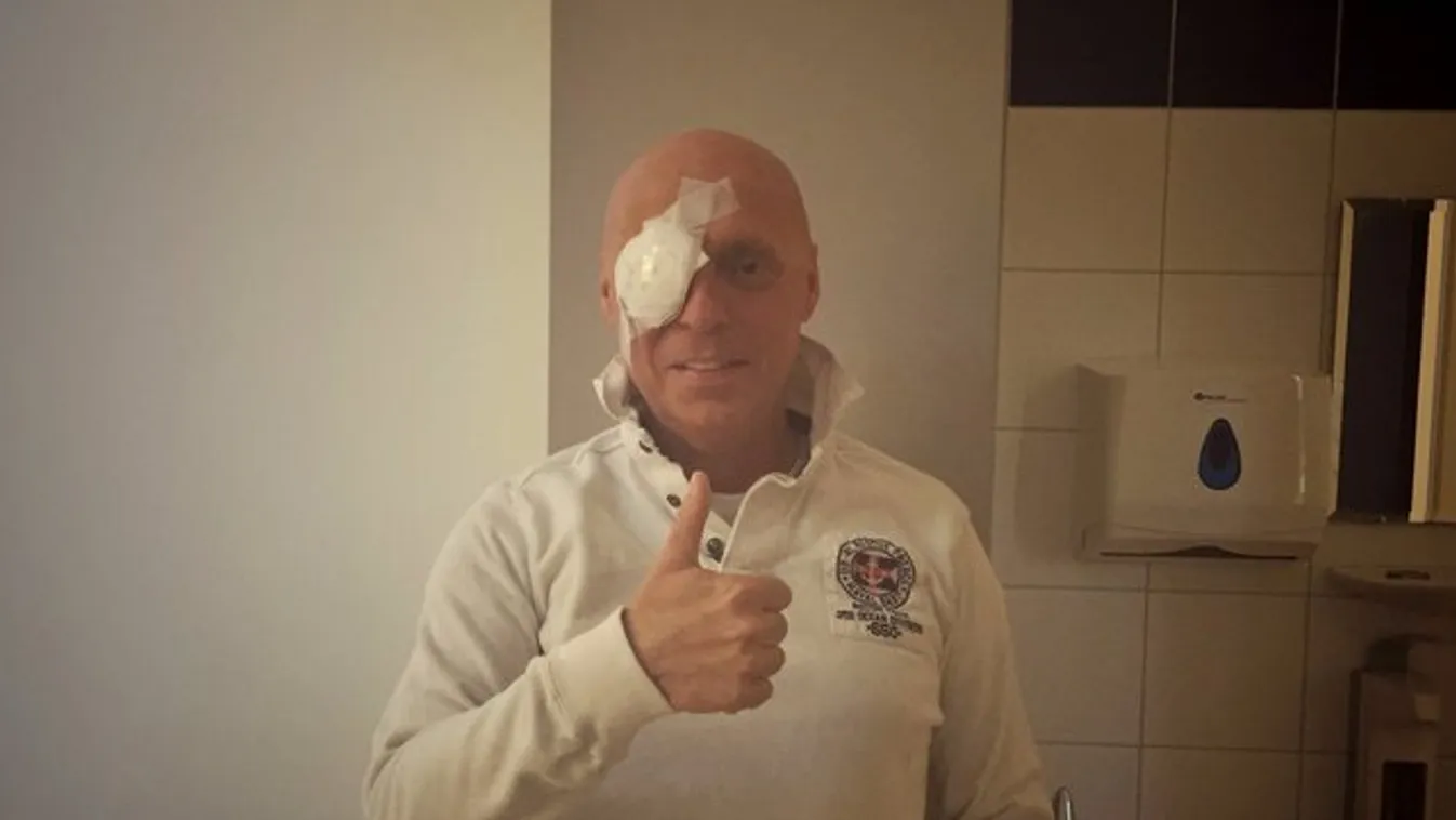 Csaknem teljesen megvakult DJ Dominique – otthon lábadozik műtétje után