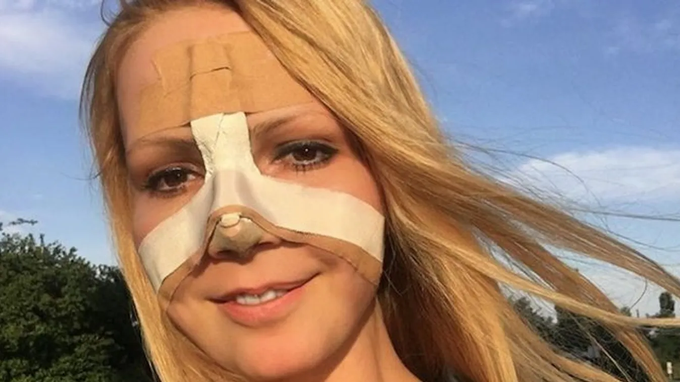 Újjászületett Vámos Erika orra hegye