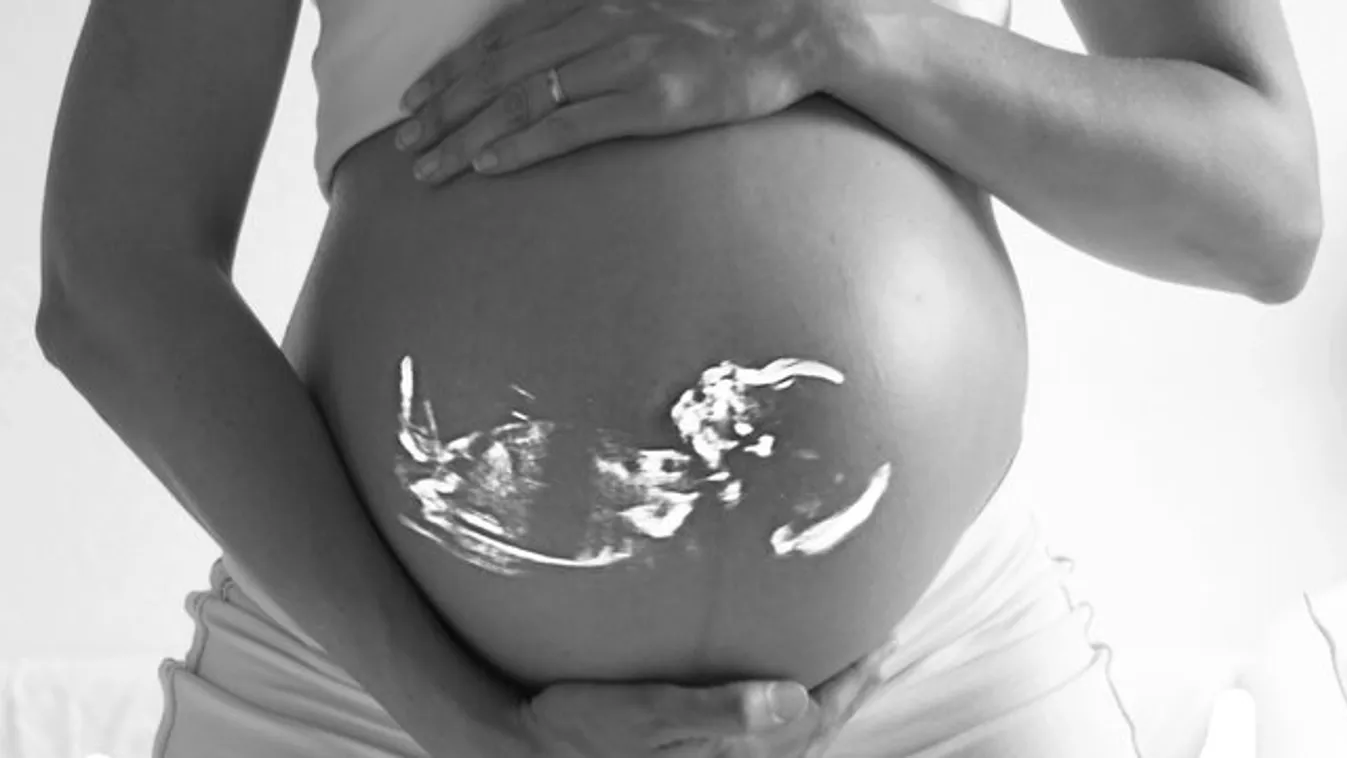 A 4D-s ultrahang felvételet látva zokogógörcsben tört ki a várandós nő - állítása szerint ez egy üzenet a mennyből